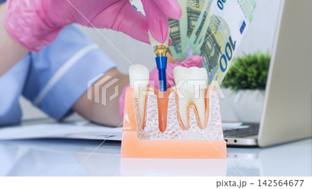 Dentist in pink medical gloves placing crown on dental implant model while holding euro banknotes. Dentist in pink medical gloves placing crown on dental implant model while holding euro banknotes. 142564677