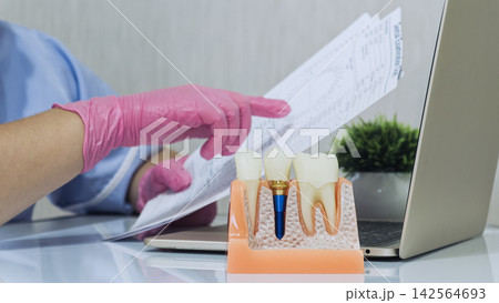 dental professional holding medical records with a titanium screw tooth implant cross section model in the foreground. dental professional holding medical records with a titanium screw tooth implant cross section model in the foreground. 142564693
