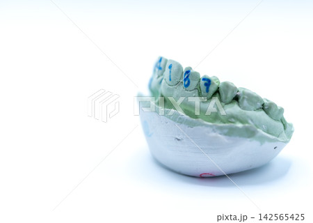 Numbered plaster dental cast showing detailed teeth jaw structure for dentistry laboratory analysis orthodontic planning prosthetic treatment Numbered plaster dental cast showing detailed teeth jaw structure for dentistry laboratory analysis orthodontic planning prosthetic treatment 142565425