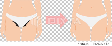 描繪女性因私密部位問題而煩惱的插圖。 142607412