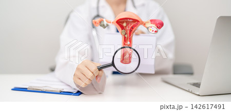 Doctor with Uterus and Ovaries anatomy model. Ovarian and Cervical cancer, Cervix disorder, Endometriosis, Hysterectomy, Uterine fibroids, Reproductive system, Pregnancy and health concept Doctor with Uterus and Ovaries anatomy model. Ovarian and Cervical cancer, Cervix disorder, Endometriosis, Hysterectomy, Uterine fibroids, Reproductive system, Pregnancy and health concept 142617491