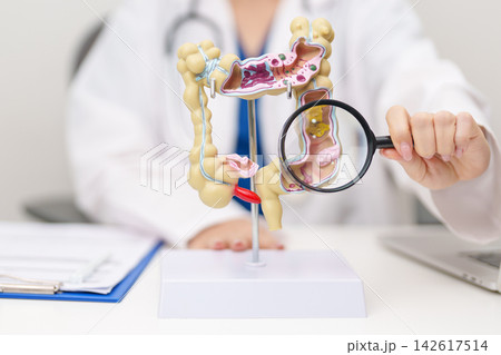 Doctor with human Colon anatomy model. Colonic disease, Large Intestine, Colorectal cancer, Ulcerative colitis, Diverticulitis, Irritable bowel syndrome, Digestive system and Healthcare concept Doctor with human Colon anatomy model. Colonic disease, Large Intestine, Colorectal cancer, Ulcerative colitis, Diverticulitis, Irritable bowel syndrome, Digestive system and Healthcare concept 142617514
