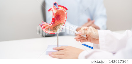 Doctor with Gastric anatomy model. Gastroenterologist consultation, stomach diseases and ulcers, November stomach cancer, Gastroesophageal Reflux Disease, GERD, Acid reflux and healthcare medical Doctor with Gastric anatomy model. Gastroenterologist consultation, stomach diseases and ulcers, November stomach cancer, Gastroesophageal Reflux Disease, GERD, Acid reflux and healthcare medical 142617564