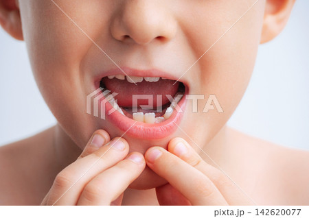 Close-up portrait of child with missing baby tooth, suitable for concepts related to children's healthcare, dental care, oral hygiene, tooth development and pediatric dentistry Close-up portrait of child with missing baby tooth, suitable for concepts related to children's healthcare, dental care, oral hygiene, tooth development and pediatric dentistry 142620077