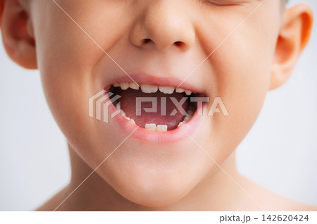 Child with missing baby teeth during the natural transition to permanent teeth. Pediatric dentistry and dental health concept, close-up on white background Child with missing baby teeth during the natural transition to permanent teeth. Pediatric dentistry and dental health concept, close-up on white background 142620424