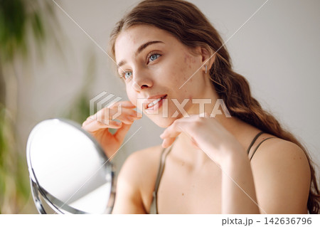 Portrait of a young woman without makeup with Acne skin. Concept of acne therapy and problem skin. Portrait of a young woman without makeup with Acne skin. Concept of acne therapy and problem skin. 142636796