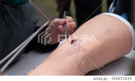 Close up of hands practicing wound suturing on synthetic leg, showing surgical tool, stitches, and simulated skin surface in clinical training environment for medical education and skills practice Close up of hands practicing wound suturing on synthetic leg, showing surgical tool, stitches, and simulated skin surface in clinical training environment for medical education and skills practice 142655839