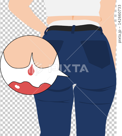 Illustration of a woman suffering from hemorrhoids Illustration of a woman suffering from hemorrhoids 142660733