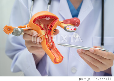 Uterus, doctor holding human anatomy model for study diagnosis and treatment in hospital. Uterus, doctor holding human anatomy model for study diagnosis and treatment in hospital. 142666411