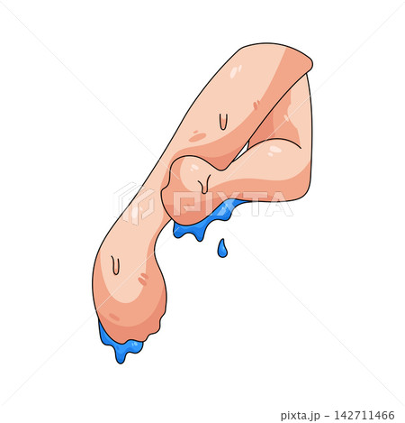 Illustration of left arm wash 142711466