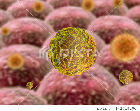 Virus infection cause chronic disease 142719206