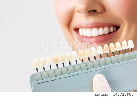 Female Smile with Dental Shade Guide for Tooth Color Matching 142725860