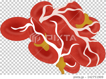 blood clot illustration blood clot illustration 142751909