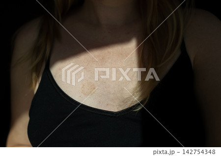 Close up of woman touching circular red skin spot on chest. Dermatological issue showing fungal infection, eczema, ringworm, rash, or contact dermatitis. Close up of woman touching circular red skin spot on chest. Dermatological issue showing fungal infection, eczema, ringworm, rash, or contact dermatitis. 142754348