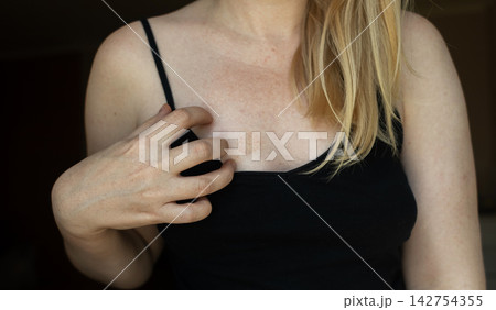 Close up of woman touching circular red skin spot on chest. Dermatological issue showing fungal infection, eczema, ringworm, rash, or contact dermatitis. Close up of woman touching circular red skin spot on chest. Dermatological issue showing fungal infection, eczema, ringworm, rash, or contact dermatitis. 142754355