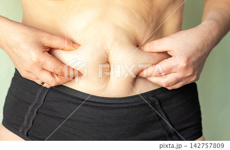 Woman pinching belly fat above black underwear, body image and weight concern close-up Woman pinching belly fat above black underwear, body image and weight concern close-up 142757809