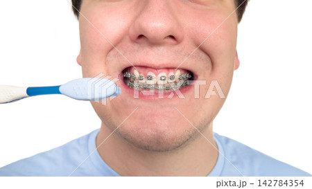 Close up of a man with dental braces smiling and holding a toothbrush, concept of oral hygiene and orthodontic treatment Close up of a man with dental braces smiling and holding a toothbrush, concept of oral hygiene and orthodontic treatment 142784354