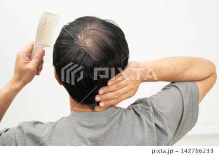 Bald in the middle head and begin no loss hair glabrous of mature Asian business smart active office man. Bald in the middle head and begin no loss hair glabrous of mature Asian business smart active office man. 142786233