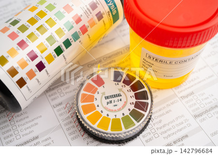 Urinalysis, urine cup with reagent strip pH paper test and comparison chart in laboratory. Urinalysis, urine cup with reagent strip pH paper test and comparison chart in laboratory. 142796684