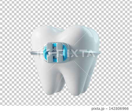 3d Tooth with a bracket frame, realistic render icon isolated on white background. Infographics installation of corrective brace 3d Tooth with a bracket frame, realistic render icon isolated on white background. Infographics installation of corrective brace 142806966