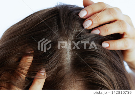 Woman Examining Scalp for Dandruff and Dryness 142810759