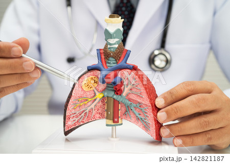 Pneumonia, lung cancer, Asian doctor with human lung model. Pneumonia, lung cancer, Asian doctor with human lung model. 142821187