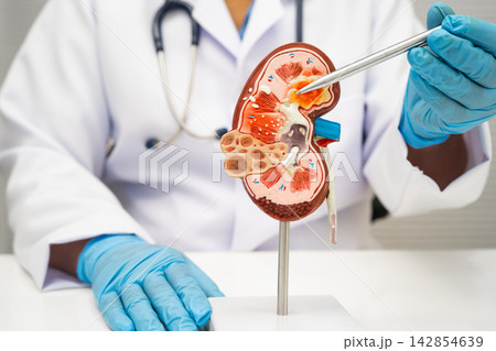 Chronic kidney disease, doctor with model for treatment urinary system, urology, Estimated glomerular filtration rate eGFR. Chronic kidney disease, doctor with model for treatment urinary system, urology, Estimated glomerular filtration rate eGFR. 142854639