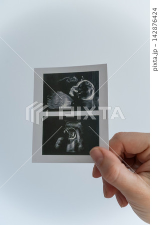 Woman holding a photo of an ultrasound scan of a baby on a white background. Woman holding a photo of an ultrasound scan of a baby on a white background. 142876424