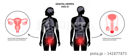Anatomy transition circles layout Anatomy transition circles layout 142877873