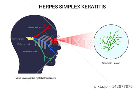 Nerve branches zoom circle Nerve branches zoom circle 142877879
