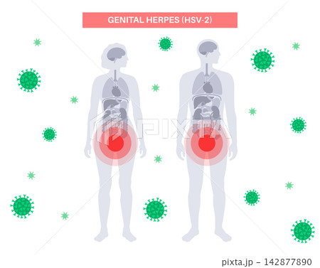 Groin target zones comparison 142877890