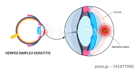 Eyeball cross section transition 142877898