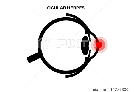 Minimal cross section outline Minimal cross section outline 142878003