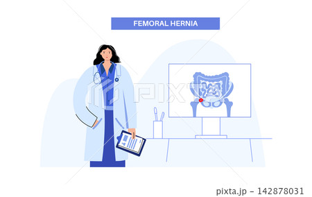 Abdominal Hernia poster Abdominal Hernia poster 142878031