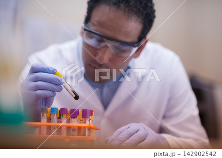 Lab technician carefully handling blood test sample in clinical laboratory wearing gloves and goggles 142902542