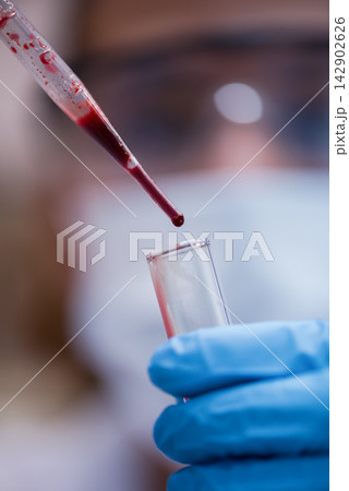 Young medical technician dropping blood sample into test tube in clinical laboratory with gloved hands Young medical technician dropping blood sample into test tube in clinical laboratory with gloved hands 142902626