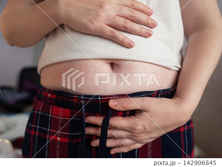 Woman touching stretch marks on belly skin. Close up of female hands holding stomach with striae after pregnancy or weight loss. Woman touching stretch marks on belly skin. Close up of female hands holding stomach with striae after pregnancy or weight loss. 142906845