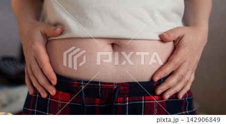 Close-up of a woman touching elastic waistband marks on her stomach skin. Tight clothing imprint caused by uncomfortable waistband and skin pressure. Close-up of a woman touching elastic waistband marks on her stomach skin. Tight clothing imprint caused by uncomfortable waistband and skin pressure. 142906849