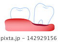 歯茎が痛んで歯が抜ける 142929156