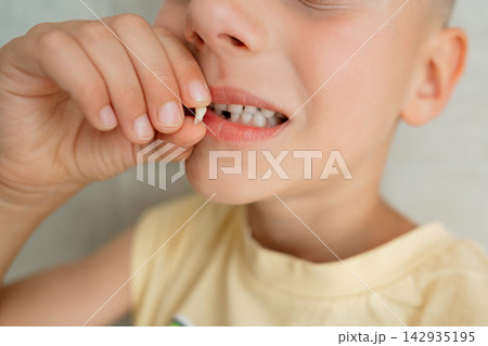 Playful child holding fallen baby tooth in hand showing gap in smile. Concept of pediatric dental health, losing first primary tooth, oral hygiene, and happy childhood moments Playful child holding fallen baby tooth in hand showing gap in smile. Concept of pediatric dental health, losing first primary tooth, oral hygiene, and happy childhood moments 142935195