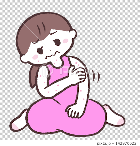 一位患有蕁麻疹的女性的插圖 一位患有蕁麻疹的女性的插圖 142970622