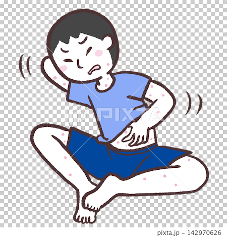 圖解:一名男子身上長滿了搔癢的蕁麻疹。 圖解:一名男子身上長滿了搔癢的蕁麻疹。 142970626