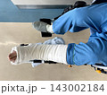 70代女性の骨折した足 70代女性の骨折した足 143002184