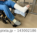 70代女性の骨折した足 70代女性の骨折した足 143002186