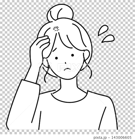 一位20多歲的年輕女性患有斑禿 一位20多歲的年輕女性患有斑禿 143006605