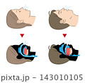 睡眠時無呼吸症候群と正常な呼吸のイラスト 143010105
