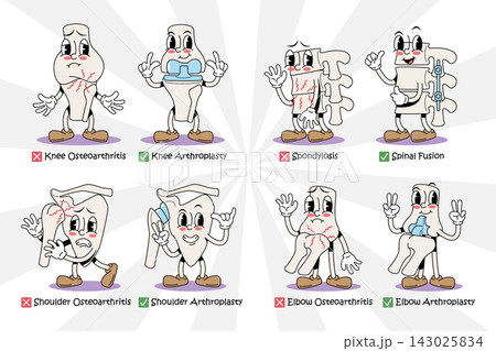 Orthopedics osteoarthritis and joint replacement arthroplasty vintage 1930s rubber hose cartoon characters set. featuring knee, spine, shoulder, elbow surgery. Vector illustration. Orthopedics osteoarthritis and joint replacement arthroplasty vintage 1930s rubber hose cartoon characters set. featuring knee, spine, shoulder, elbow surgery. Vector illustration. 143025834