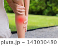 Close up of person grasping bare calf muscle with red highlighted area indicating severe leg pain, muscle cramp, strain, or sports injury. Healthcare, physical therapy, medical concept outdoors. 143030480