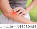 Close up of person holding arm with red highlighted area indicating severe pain, muscle strain, joint inflammation, or allergic skin rash. Healthcare, physical therapy, and medical concept outdoors. 143030484