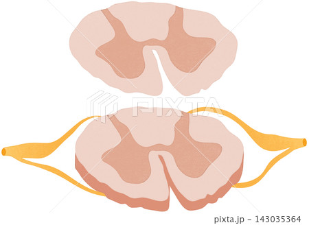 anterolateral system illustration 143035364
